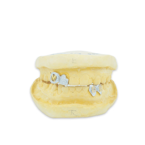 Custom 4 Cap Grillz