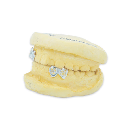 Custom 4 Cap Grillz
